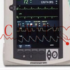 เครื่องหัวใจ 12 นิ้ว, เครื่องช็อตไฟฟ้าสำหรับผู้ใหญ่ที่ใช้สำหรับหัวใจ