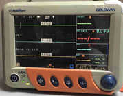 Goldway UT4000Apro ใช้จอภาพผู้ป่วยพร้อมจอแสดงผล TFT ขนาด 12.1 นิ้ว