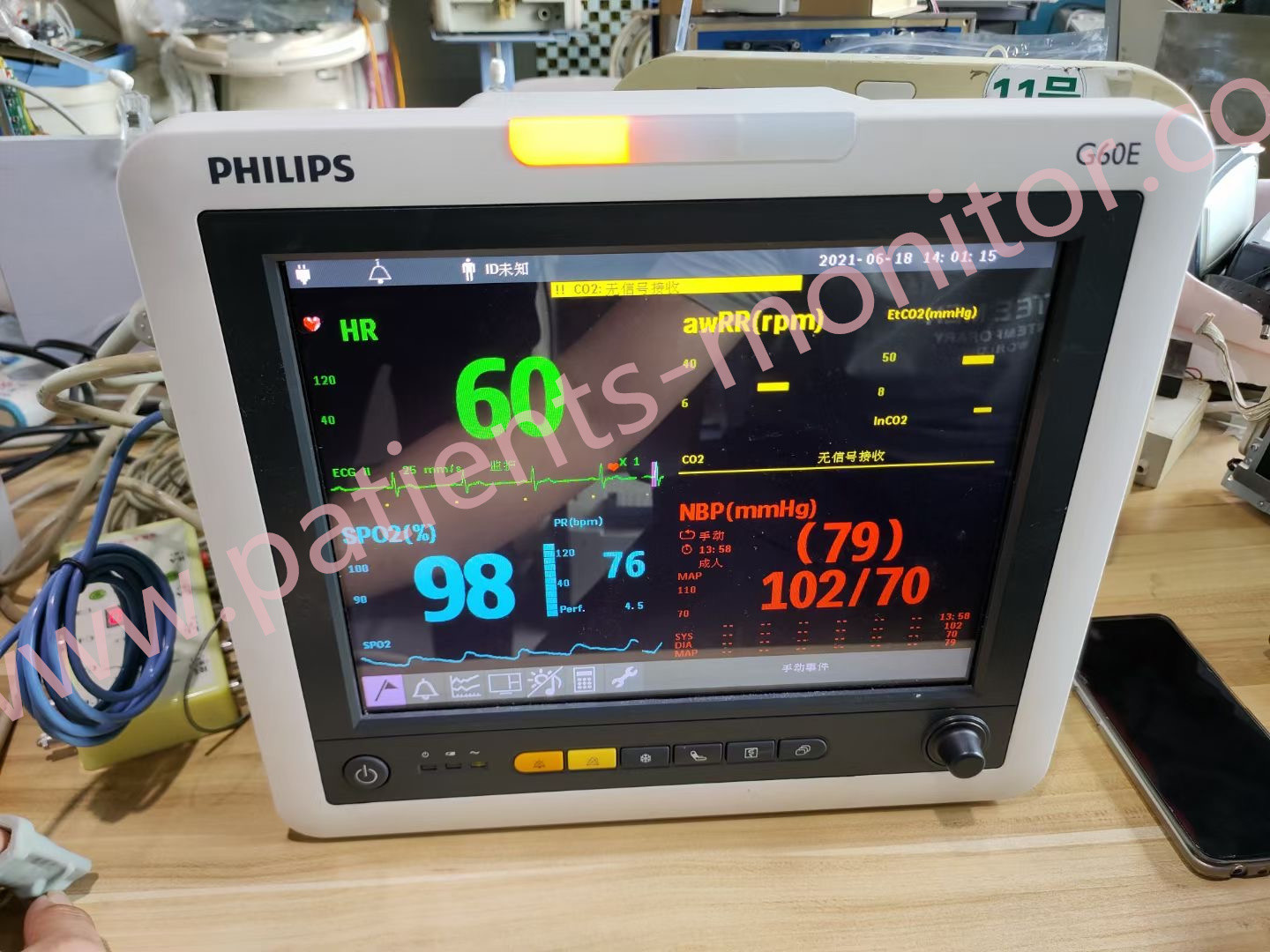 Philip G60E เครื่องตรวจผู้ป่วยไอซียูสำหรับคลินิกโรงพยาบาล